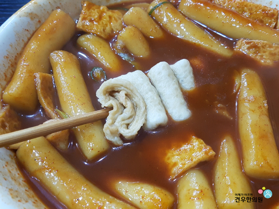 고릴라떡볶이 이미지